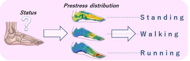 How foot stress (prestress) distribution varies with foot function.