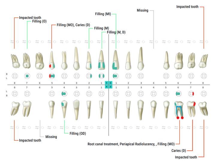 Dental Charting by EM2AI