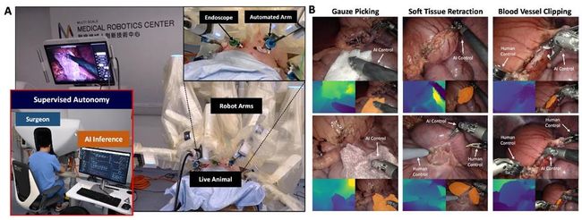 Cornerstone Robotics Completes World's First Clinical Validation of Autonomous Surgery Performed by Robot-Assisted Surgery