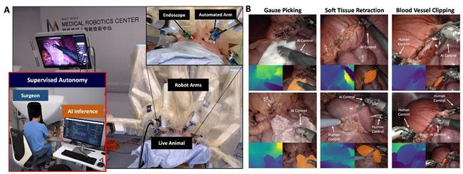 全球首例！康諾思騰手術機械人完成臨床場景下自主手術驗證