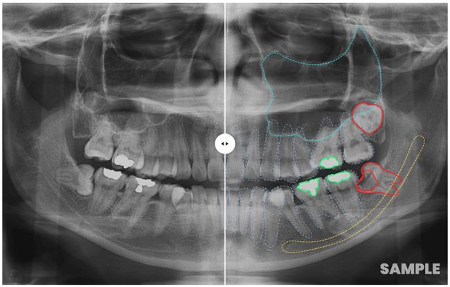 EM2AI Revolutionising the Dental Industry: New AI Products Promise Transparent Treatment Plans for Patients