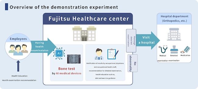 Fujitsu and iSurgery launch bone health promotion project in Japan with Jikei University School of Medicine aiming for early detection of osteoporosis