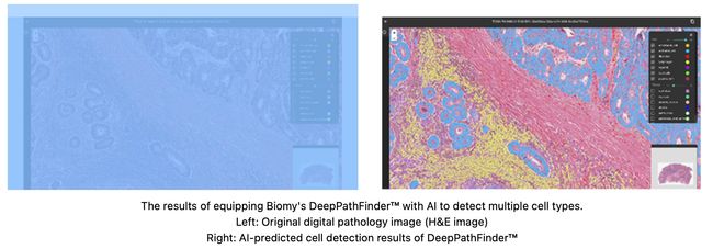 NEC and Biomy Partner to Develop and Expand AI-Based Analytical Platforms in the Digital Pathology Field